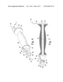 SURGICAL METHOD FOR IMPLANTING A STEMLESS HUMERAL COMPONENT TO THE HUMERUS     OF A PATIENT diagram and image