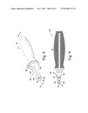 SURGICAL METHOD FOR IMPLANTING A STEMLESS HUMERAL COMPONENT TO THE HUMERUS     OF A PATIENT diagram and image