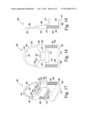 SURGICAL METHOD FOR IMPLANTING A STEMLESS HUMERAL COMPONENT TO THE HUMERUS     OF A PATIENT diagram and image