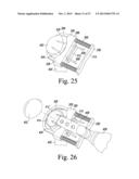 SURGICAL METHOD FOR IMPLANTING A STEMLESS HUMERAL COMPONENT TO THE HUMERUS     OF A PATIENT diagram and image