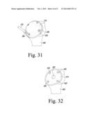 SURGICAL METHOD FOR IMPLANTING A STEMLESS HUMERAL COMPONENT TO THE HUMERUS     OF A PATIENT diagram and image