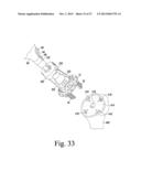 SURGICAL METHOD FOR IMPLANTING A STEMLESS HUMERAL COMPONENT TO THE HUMERUS     OF A PATIENT diagram and image