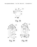 SURGICAL METHOD FOR IMPLANTING A STEMLESS HUMERAL COMPONENT TO THE HUMERUS     OF A PATIENT diagram and image