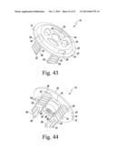 SURGICAL METHOD FOR IMPLANTING A STEMLESS HUMERAL COMPONENT TO THE HUMERUS     OF A PATIENT diagram and image