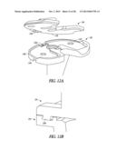 TIBIAL PROSTHESIS SYSTEMS, KITS, AND METHODS diagram and image