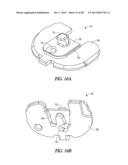 TIBIAL PROSTHESIS SYSTEMS, KITS, AND METHODS diagram and image