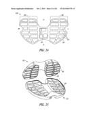 TIBIAL PROSTHESIS SYSTEMS, KITS, AND METHODS diagram and image