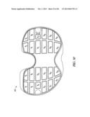 TIBIAL PROSTHESIS SYSTEMS, KITS, AND METHODS diagram and image