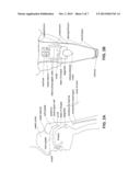 DEVICES AND METHODS FOR TREATING SLEEP DISORDERED BREATHING diagram and image