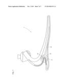 FOOT PROSTHESIS diagram and image