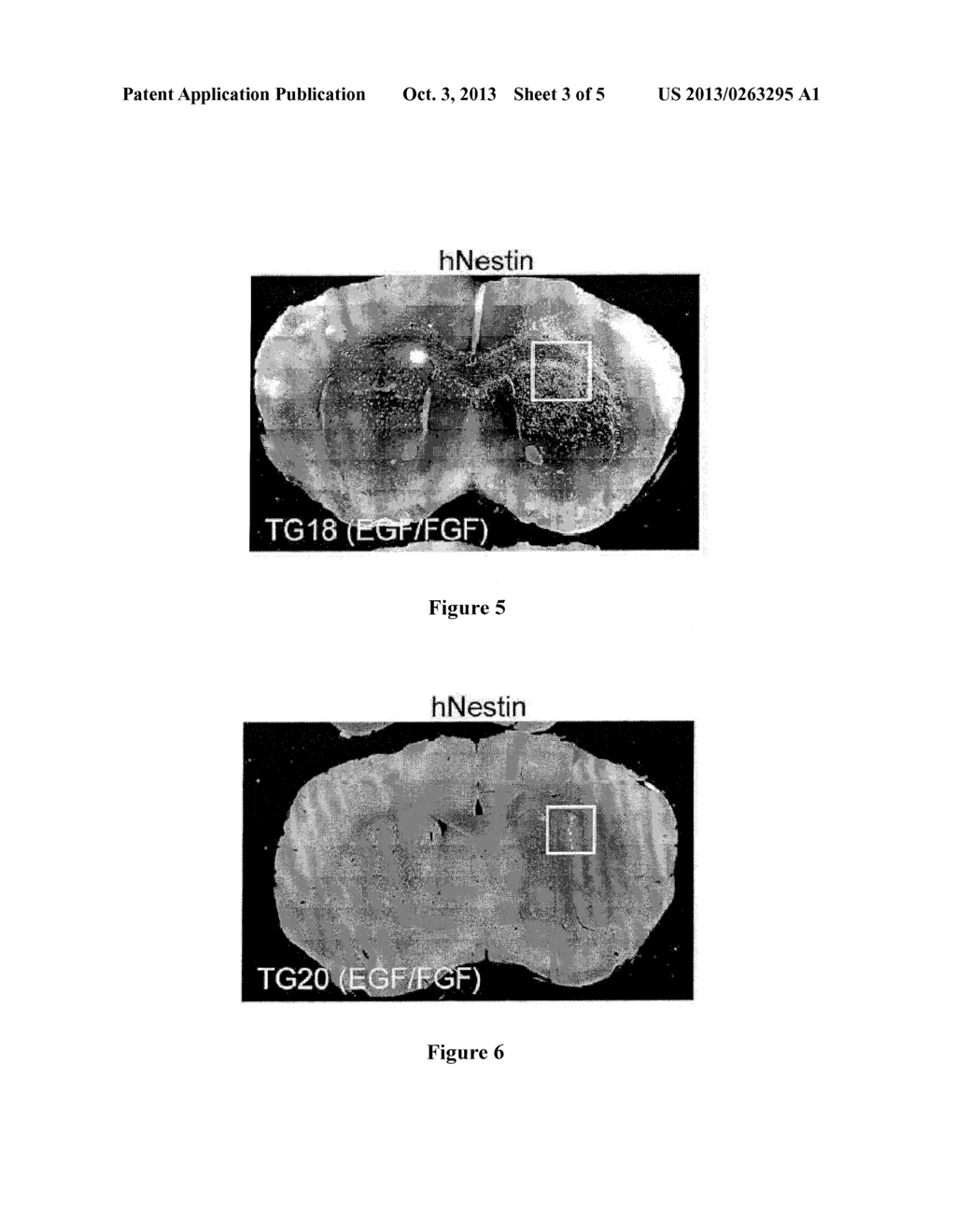 Glioma Stem Cells and Methods for Obtaining Them - diagram, schematic, and image 04