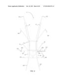 Stokes Litter Victim Harness diagram and image