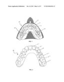 TOOTH POSITIONERS, METHOD AND APPARATUS F0R MAKING THE SAME, AND METHOD OF     POSITIONING TEETH USING THE SAME diagram and image