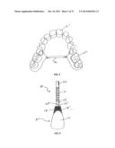 TOOTH POSITIONERS, METHOD AND APPARATUS F0R MAKING THE SAME, AND METHOD OF     POSITIONING TEETH USING THE SAME diagram and image