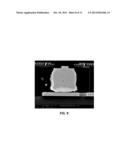 FLUXING-ENCAPSULANT MATERIAL FOR MICROELECTRONIC PACKAGES ASSEMBLED VIA     THERMAL COMPRESSION BONDING PROCESS diagram and image