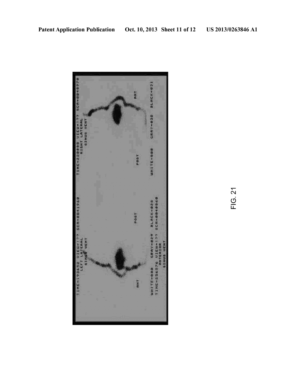 PARTICLE DISPERSION DEVICE FOR NASAL DELIVERY - diagram, schematic, and image 12