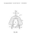 METHODS AND SYSTEMS FOR IMPROVING AIRWAY PATENCY diagram and image