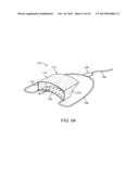 METHODS AND SYSTEMS FOR IMPROVING AIRWAY PATENCY diagram and image