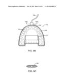 METHODS AND SYSTEMS FOR IMPROVING AIRWAY PATENCY diagram and image