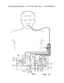 METHODS AND SYSTEMS FOR IMPROVING AIRWAY PATENCY diagram and image