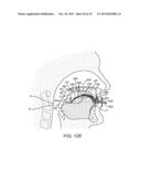 METHODS AND SYSTEMS FOR IMPROVING AIRWAY PATENCY diagram and image