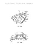 METHODS AND SYSTEMS FOR IMPROVING AIRWAY PATENCY diagram and image