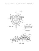 METHODS AND SYSTEMS FOR IMPROVING AIRWAY PATENCY diagram and image