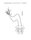 METHODS AND SYSTEMS FOR IMPROVING AIRWAY PATENCY diagram and image