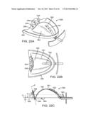 METHODS AND SYSTEMS FOR IMPROVING AIRWAY PATENCY diagram and image