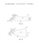 METHODS AND SYSTEMS FOR IMPROVING AIRWAY PATENCY diagram and image