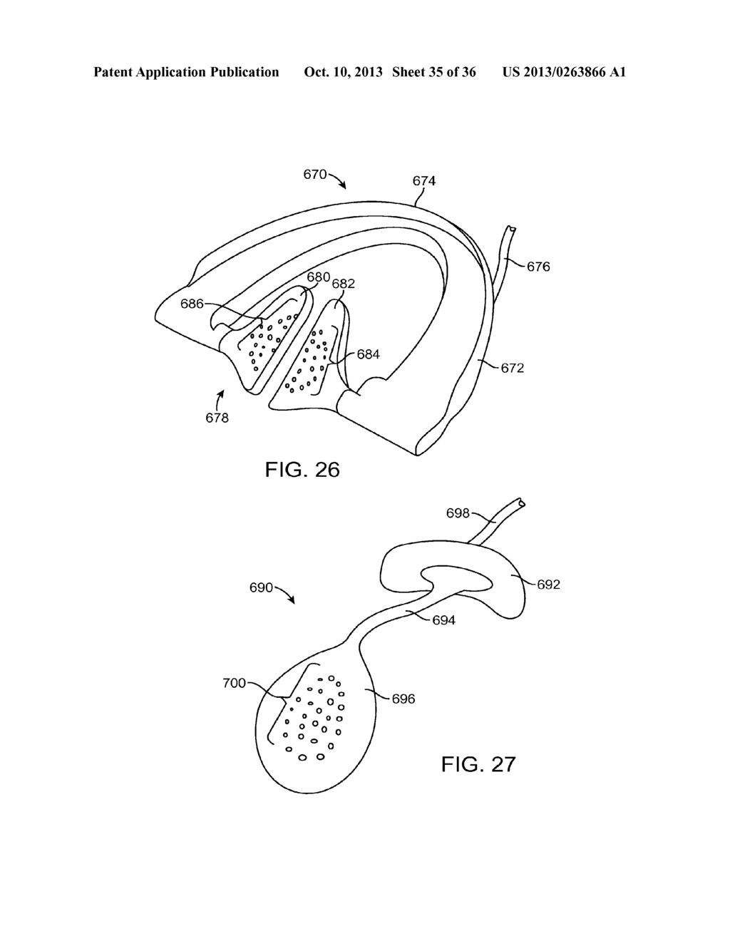 METHODS AND SYSTEMS FOR IMPROVING AIRWAY PATENCY - diagram, schematic, and image 36