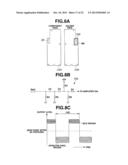 ENDOSCOPE diagram and image