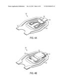 GIMBAL ASSEMBLY WITH A GOLD TONGUE/DIMPLE INTERFACE AND METHODS OF MAKING     THE SAME diagram and image