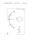 Magnification Marker for Radiography diagram and image