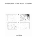 Humanized Anti-CD22 Antibodies And Their Use In Treatment Of Oncology,     Transplantation And Autoimmune Disease diagram and image