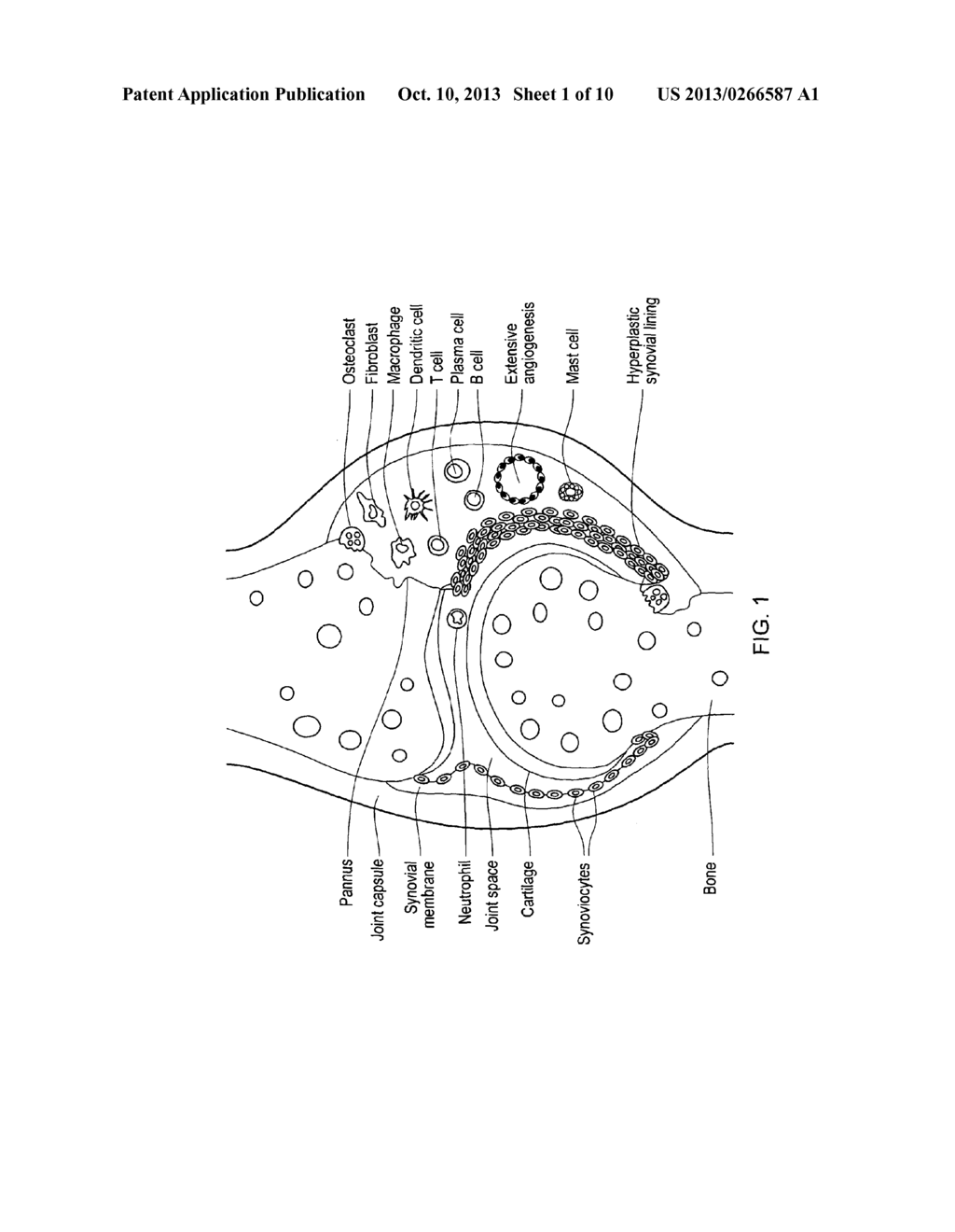 ANTIBODY SPECIFICALLY BINDING SYNOVIAL MICROVASCULATURE OF ARTHRITIS     PATIENTS - diagram, schematic, and image 02