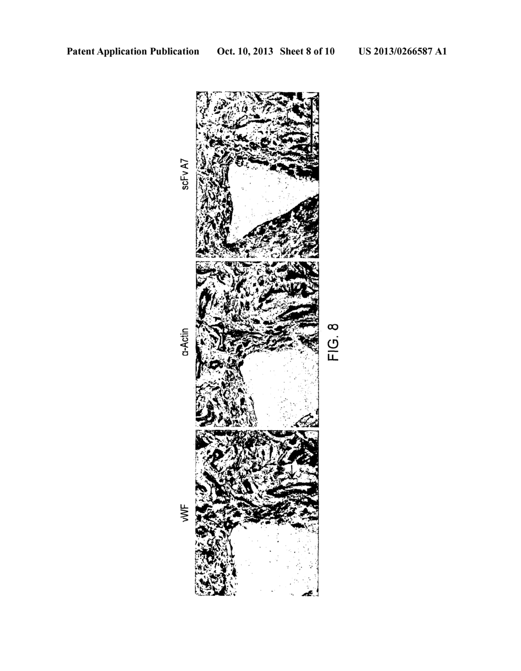 ANTIBODY SPECIFICALLY BINDING SYNOVIAL MICROVASCULATURE OF ARTHRITIS     PATIENTS - diagram, schematic, and image 09