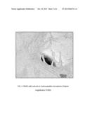 Preparation of controlled drug release porous hydroxyapatite microspheres     with interconnected pore channels diagram and image