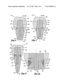 DENTAL IMPLANT diagram and image