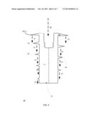 DENTAL IMPLANT diagram and image