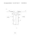 DENTAL IMPLANT diagram and image