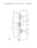 DENTAL IMPLANT, A DENTAL IMPLANT KIT AND A METHOD OF SECURING A DENTAL     BRIDGE TO THE JAW OF A PATIENT diagram and image