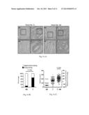 PLASMA BIOMARKER FOR DISTAL METASTASIS IN COLORECTAL CANCER diagram and image