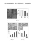 PLASMA BIOMARKER FOR DISTAL METASTASIS IN COLORECTAL CANCER diagram and image