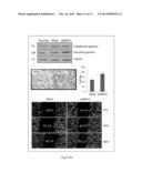 PLASMA BIOMARKER FOR DISTAL METASTASIS IN COLORECTAL CANCER diagram and image