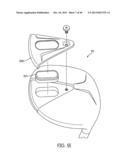 Golf Clubs and Golf Club Heads diagram and image