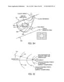 Golf Clubs and Golf Club Heads diagram and image