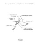 Method and system for rotary coupling and planetary gear diagram and image