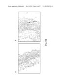 METHOD AND REAGENT FOR DIAGNOSIS AND/OR EVALUATION OF PROGRESSION OF     GRAFT-VERSUS-HOST DISEASE diagram and image