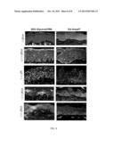 THERAPEUTIC APPLICATIONS OF SMAD7 diagram and image